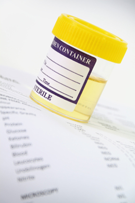 Urinalysis Testing in West Hollywood, CA
